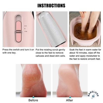 BareLuxe Electric Callus Remover